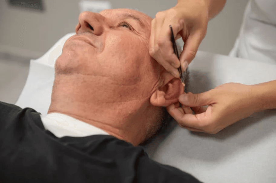 Salt Lake City Dry Needling Techniques